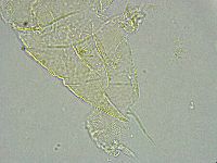 Pseudechiniscus ramazzottii image