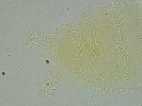 Pseudechiniscus ramazzottii facettalis image
