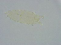 Pseudechiniscus ramazzottii image