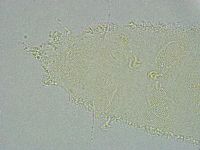 Pseudechiniscus ramazzottii image