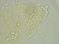 Pseudechiniscus ramazzottii image