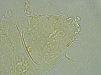Pseudechiniscus ramazzottii facettalis image