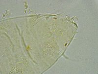 Pseudechiniscus ramazzottii facettalis image