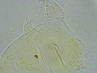Pseudechiniscus ramazzottii facettalis image