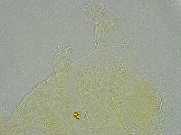 Pseudechiniscus ramazzottii image