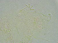 Pseudechiniscus ramazzottii facettalis image
