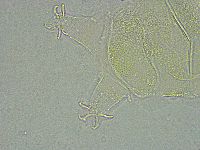 Pseudechiniscus ramazzottii image