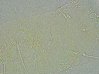 Pseudechiniscus ramazzottii image