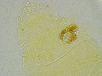 Pseudechiniscus ramazzottii facettalis image