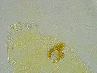 Pseudechiniscus ramazzottii image