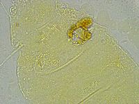 Pseudechiniscus ramazzottii image