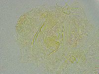 Pseudechiniscus ramazzottii image