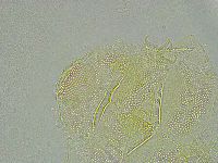 Pseudechiniscus ramazzottii image