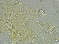 Pseudechiniscus ramazzottii image