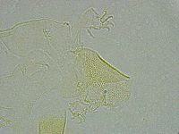 Pseudechiniscus ramazzottii image