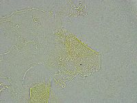 Pseudechiniscus ramazzottii facettalis image