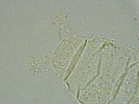 Pseudechiniscus ramazzottii image