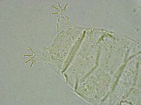 Pseudechiniscus ramazzottii facettalis image