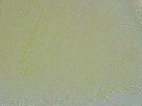 Pseudechiniscus ramazzottii image