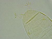 Pseudechiniscus ramazzottii image