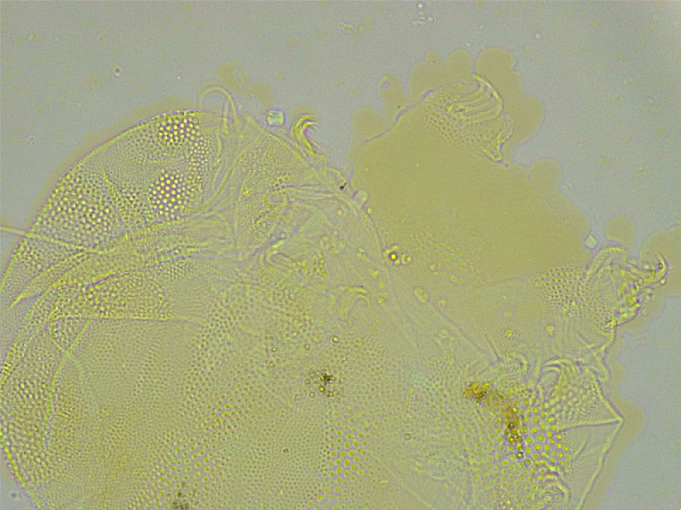 Pseudechiniscus ramazzottii image