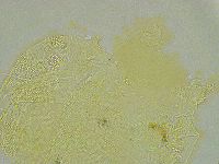 Pseudechiniscus ramazzottii image