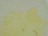 Pseudechiniscus ramazzottii facettalis image