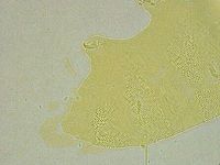 Pseudechiniscus ramazzottii image