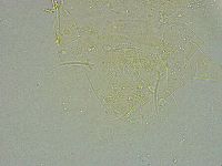 Pseudechiniscus ramazzottii image