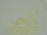 Pseudechiniscus ramazzottii image