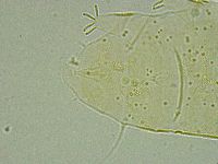 Pseudechiniscus ramazzottii facettalis image