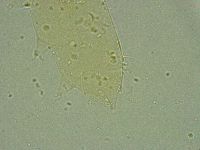 Pseudechiniscus ramazzottii image