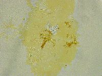 Pseudechiniscus ramazzottii facettalis image