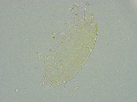 Pseudechiniscus ramazzottii image