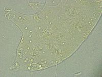 Pseudechiniscus ramazzottii facettalis image
