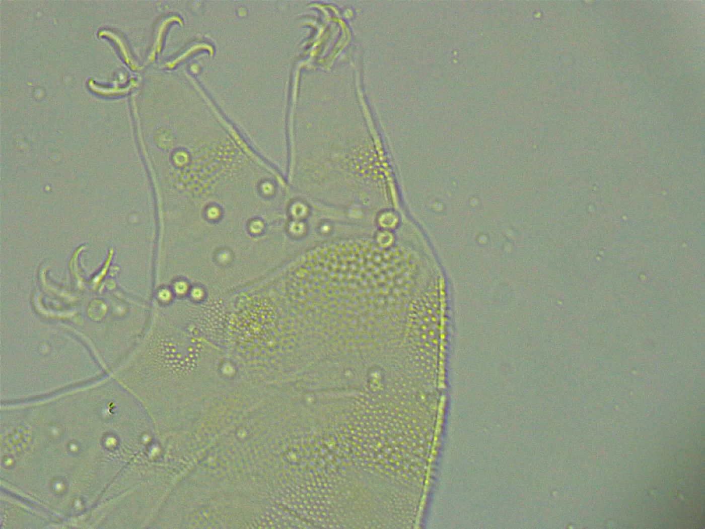 Pseudechiniscus ramazzottii facettalis image