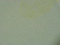 Pseudechiniscus ramazzottii facettalis image