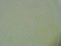 Pseudechiniscus ramazzottii image