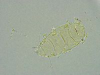 Pseudechiniscus ramazzottii image
