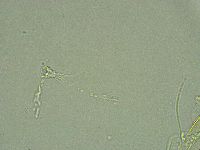 Pseudechiniscus ramazzottii image