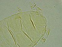 Pseudechiniscus ramazzottii image