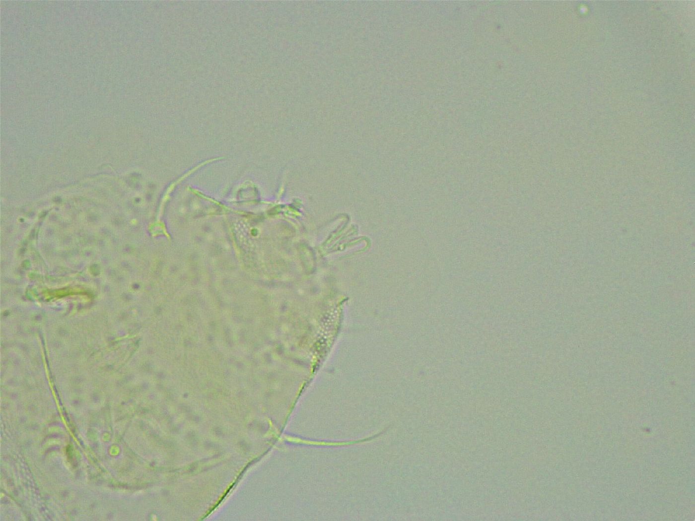 Pseudechiniscus suillus image