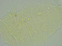 Pseudechiniscus suillus image