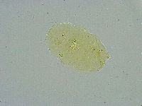 Pseudechiniscus suillus image