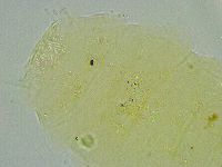 Pseudechiniscus suillus image