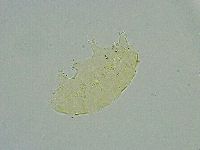 Pseudechiniscus suillus image