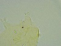 Pseudechiniscus suillus image