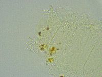 Pseudechiniscus suillus image