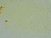 Pseudechiniscus suillus image