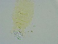 Pseudechiniscus ramazzottii image